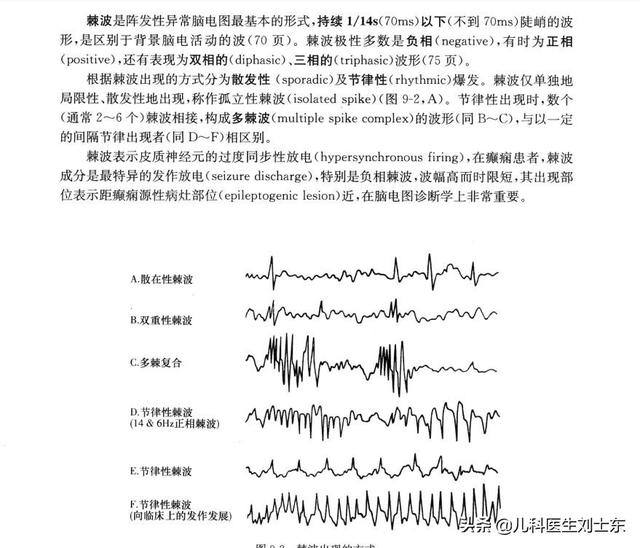 小儿脑电图判读 精述 小儿脑电图判读 精述