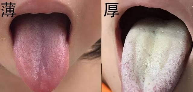 三招教会你看孩子舌苔